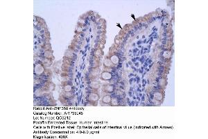Human Intestine (ZNF358 anticorps  (N-Term))