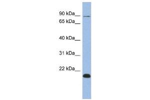 WB Suggested Anti-TCEB3B  Antibody Titration: 0. (TCEB3B anticorps  (Middle Region))