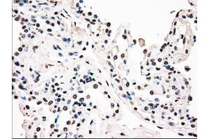 anti-B-Raf proto-oncogene, serine/threonine kinase (BRAF) antibody