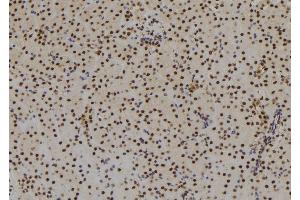 ABIN6279503 at 1/100 staining Mouse kidney tissue by IHC-P. (SIX3 anticorps  (C-Term))