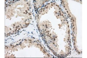 Immunohistochemical staining of paraffin-embedded Human Kidney tissue using anti-PDE4A mouse monoclonal antibody. (PDE4A anticorps)