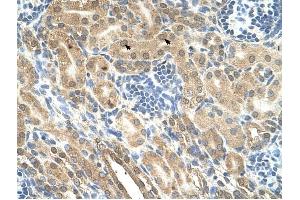IHH antibody was used for immunohistochemistry at a concentration of 4-8 ug/ml to stain Epithelial cells of renal tubule (arrows) in Human Kidney. (Indian Hedgehog anticorps)
