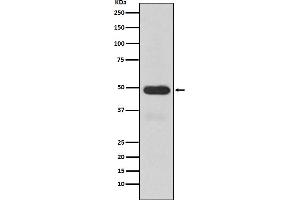 Western blot analysis of Cytochrome P450 3A4 expression in Human fetal liver lysate.