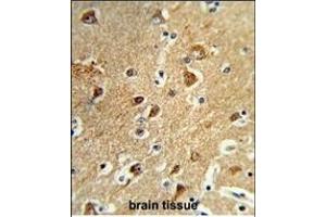 Formalin-fixed and paraffin-embedded human brain tissue reacted with M1H Antibody (Center), which was peroxidase-conjugated to the secondary antibody, followed by DAB staining. (PPM1H anticorps  (AA 235-263))