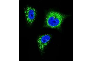 Confocal immunofluorescent analysis of TrkA Antibody f with MDA-M cell followed by Alexa Fluor 488-conjugated goat anti-rabbit lgG (green). (TRKA anticorps)