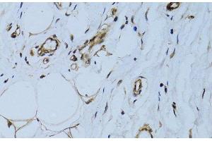 Immunohistochemistry of paraffin-embedded Human breast using MCAM Polyclonal Antibody at dilution of 1:100 (40x lens). (MCAM anticorps)