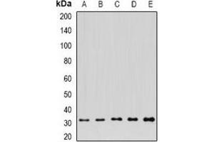 Western blot analysis of FGFBP1 expression in A549 (A), HepG2 (B), NIH3T3 (C), mouse kidney (D), rat brain (E) whole cell lysates. (FGFBP1 anticorps)