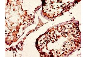 Immunohistochemistry of paraffin-embedded human testis tissue using ABIN7158234 at dilution of 1:100 (CD37 anticorps  (AA 109-237))