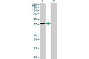 Western Blot analysis of GALM expression in transfected 293T cell line by GALM MaxPab polyclonal antibody. (GALM anticorps  (AA 1-342))