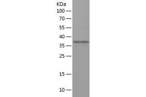 Western Blotting (WB) image for 5'-Nucleotidase, Cytosolic II (NT5C2) (AA 182-335) protein (His-IF2DI Tag) (ABIN7121622)