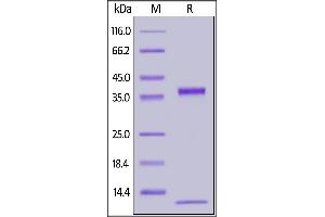 FCGRT & B2M (AA 24-297) protein (His tag,AVI tag,Biotin)