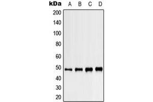 Western blot analysis of Kir3. (KCNJ5 anticorps  (C-Term))
