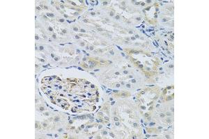 Immunohistochemistry of paraffin-embedded rat kidney using SLC29A1 antibody (ABIN6293826) at dilution of 1:100 (40x lens). (SLC29A1 anticorps)