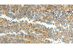 Immunohistochemistry of paraffin-embedded Human tonsil using CFHR1 Polyclonal Antibody at dilution of 1:40 (CFHR1 anticorps)