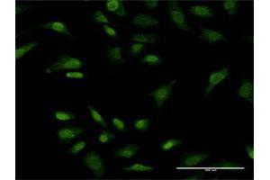 Immunofluorescence of monoclonal antibody to PRKRIP1 on HeLa cell. (PRKRIP1 anticorps  (AA 1-184))