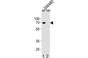 Western Blotting (WB) image for anti-Ets Variant 5 (ETV5) antibody (ABIN2995808) (ETV5 anticorps)