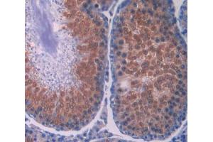 IHC-P analysis of testis tissue, with DAB staining.