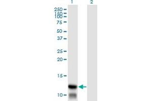 Western Blotting (WB) image for anti-Translocase of Inner Mitochondrial Membrane 8A (TIMM8A) (AA 9-98) antibody (ABIN598643) (TIMM8A/DDP anticorps  (AA 9-98))