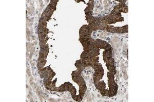 Immunohistochemical staining of human prostate with KRTAP27-1 polyclonal antibody  strong cytoplasmic positivity in glandular cells at 1:200-1:500 dilution.