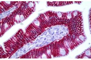 Anti-CLDN1 / Claudin 1 antibody IHC staining of human small intestine. (Claudin 1 anticorps  (AA 162-211))