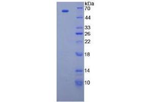 SDS-PAGE analysis of Human CUZD1 Protein. (CUZD1 Protéine)
