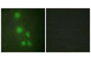 Immunofluorescence analysis of HUVEC cells, using ACL6A antibody.