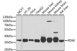 Western blot analysis of extracts of various cell lines using PDXK Polyclonal Antibody at dilution of 1:1000. (PDXK anticorps)