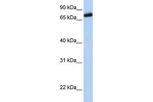 WB Suggested Anti-LRCH4 Antibody Titration:  0.