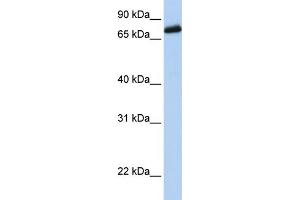 WB Suggested Anti-LRCH4 Antibody Titration:  0. (LRCH4 anticorps  (Middle Region))