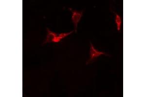 ABIN6275968 staining Hela cells by IF/ICC. (Adenosine A2a Receptor anticorps  (Internal Region))