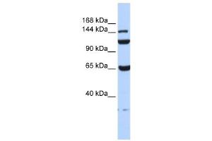 C17ORF57 antibody used at 1 ug/ml to detect target protein. (C17orf57 anticorps  (N-Term))