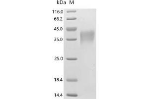 Triggering Receptor Expressed On Myeloid Cells 1 (TREM1) (AA 21-200) protein (His tag)