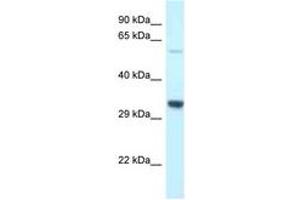 Image no. 1 for anti-Transmembrane Protein 117 (TMEM117) (AA 299-348) antibody (ABIN6747666) (TMEM117 anticorps  (AA 299-348))