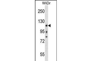 KIT Antibody (Center /) (ABIN1538491 and ABIN2838352) western blot analysis in WiDr cell line lysates (35 μg/lane). (KIT anticorps  (AA 547-577))