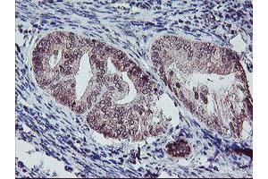 Image no. 6 for anti-Protein Phosphatase 1, Regulatory (Inhibitor) Subunit 15A (PPP1R15A) antibody (ABIN1498364)