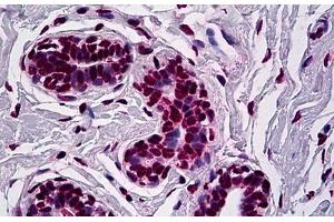 Human Breast: Formalin-Fixed, Paraffin-Embedded (FFPE)