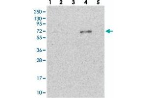 Western blot analysis of Lane 1: RT-4, Lane 2: U-251 MG, Lane 3: Human Plasma, Lane 4: Liver, Lane 5: Tonsil with ETFDH polyclonal antibody . (ETFDH anticorps)