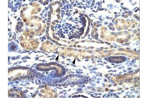 IHC Suggested Anti-SNAI1 Antibody Titration: 4-8ug/mlTissue: Human Kidney, epithelial cells of renal tube (indicated with arrows)Magnification:400X (SNAIL anticorps  (N-Term))