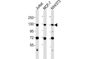 All lanes : Anti-MCM2 Antibody (C-term) at 1:2000 dilution Lane 1: Jurkat whole cell lysates Lane 2: MCF-7 whole cell lysates Lane 3: NIH/3T3 whole cell lysates Lysates/proteins at 20 μg per lane. (MCM2 anticorps  (C-Term))