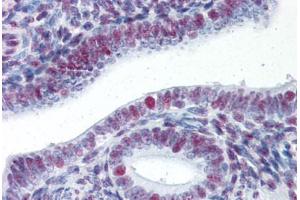 Human Uterus (formalin-fixed, paraffin-embedded) stained with HSF1 antibody ABIN337399 at 5 ug/ml followed by biotinylated goat anti-rabbit IgG secondary antibody ABIN481713, alkaline phosphatase-streptavidin and chromogen.