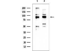 anti-Chloride Intracellular Channel 6 (CLIC6) (Internal Region) antibody