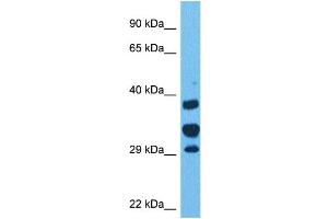 Host:  Rabbit  Target Name:  ANP32E  Sample Tissue:  Human 293T Whole Cell  Antibody Dilution:  1ug/ml