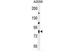 C6orf70 Antibody (Center) western blot analysis in A2058 cell line lysates (35µg/lane). (C6orf70 anticorps  (Middle Region))