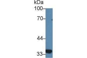 Detection of SLC30A8 in Human BXPC3 cell lysate using Polyclonal Antibody to Solute Carrier Family 30 Member 8 (SLC30A8) (SLC30A8 anticorps  (AA 263-369))