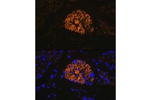 Immunofluorescence analysis of mouse bladder using Cytokeratin 13 (KRT13) (KRT13) Rabbit mAb (ABIN7268089) at dilution of 1:100 (40x lens). (Cytokeratin 13 anticorps)