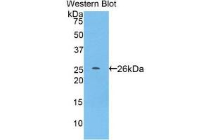 Western Blotting (WB) image for anti-Pepsin antibody (ABIN3208206)