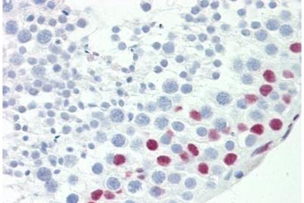 TCEAL3 Antikörper  (AA 15-43)