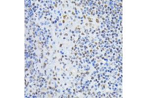 Immunohistochemistry of paraffin-embedded rat spleen using PTBP1 antibody  at dilution of 1:100 (40x lens).