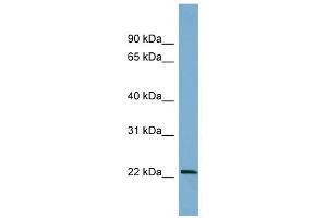 BTG4 antibody used at 1 ug/ml to detect target protein.