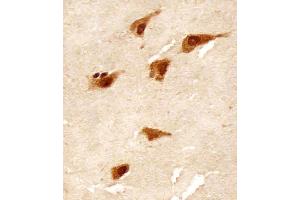 (ABIN392371 and ABIN2842007) staining TBK in human brain tissue sections by Immunohistochemistry (IHC-P - paraformaldehyde-fixed, paraffin-embedded sections).